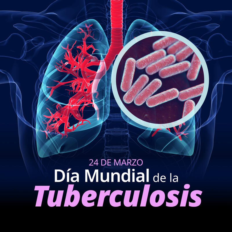 Refuerza Querétaro acciones contra la tuberculosis en su día mundial